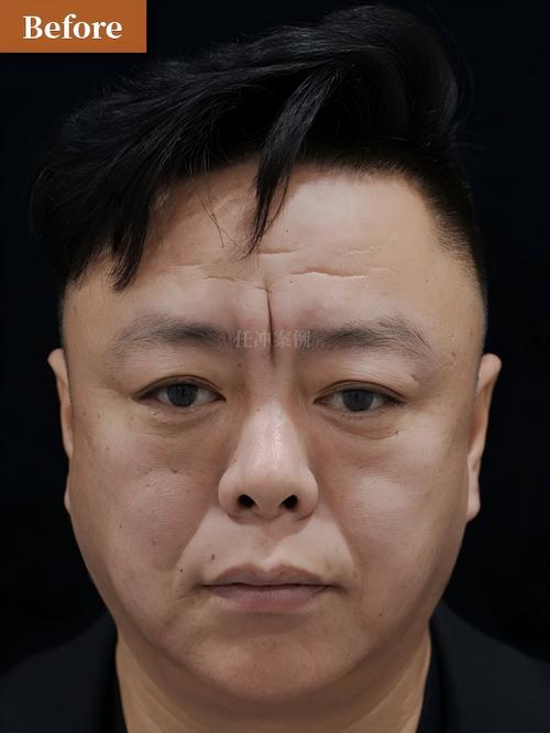 众保24小时在线套医保微信能用吗怎么弄？官方解答来了
